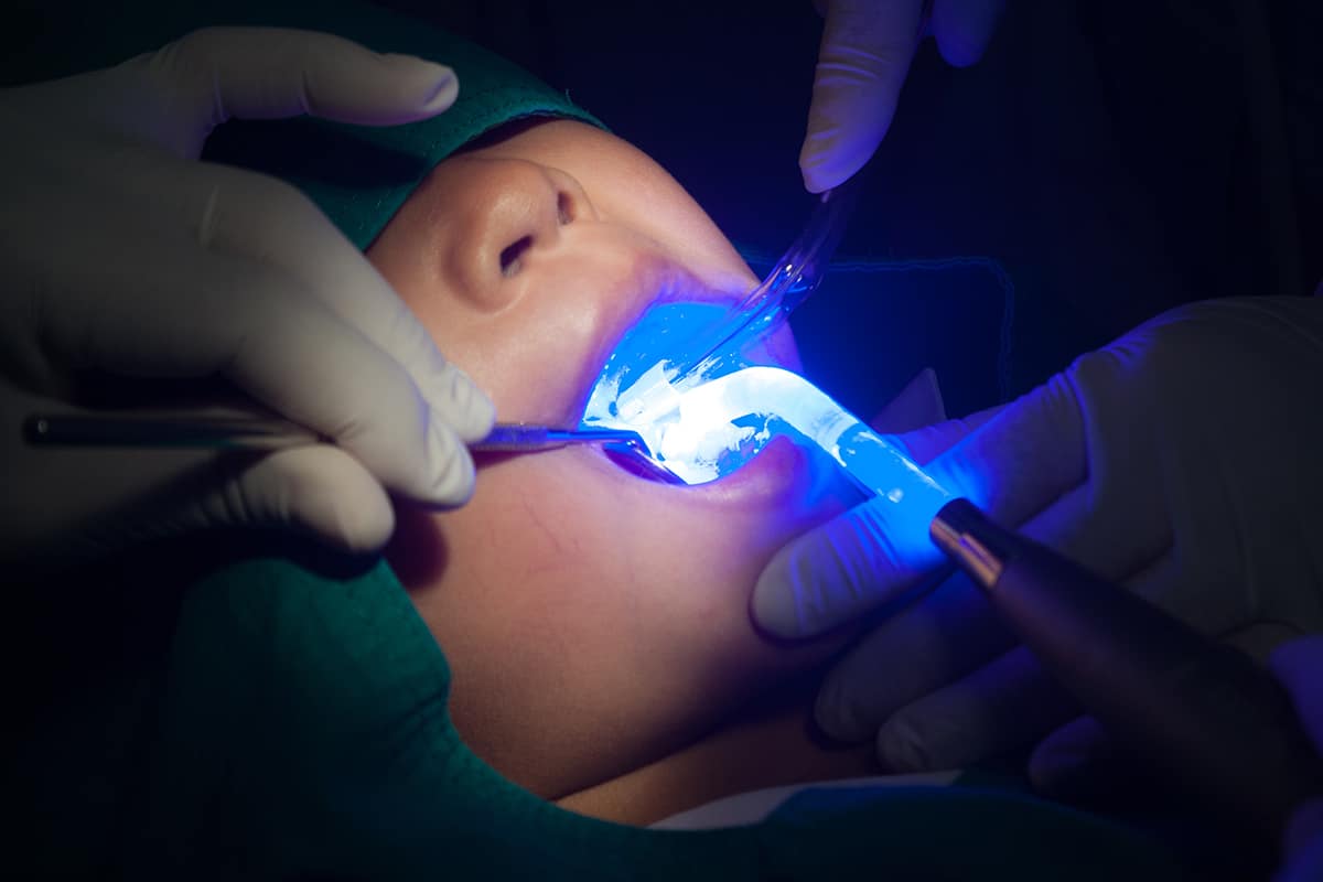 a patient undergoing dental sealants