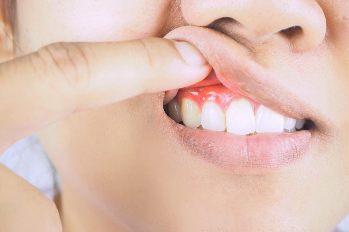 a woman checking her gums for gum disease