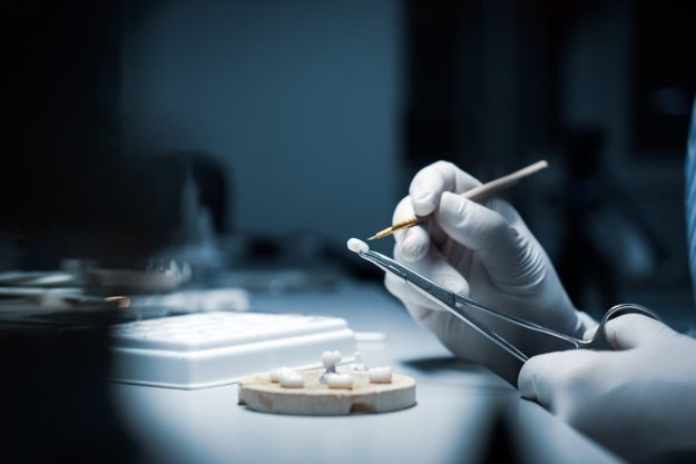 a doctor working on single tooth implant