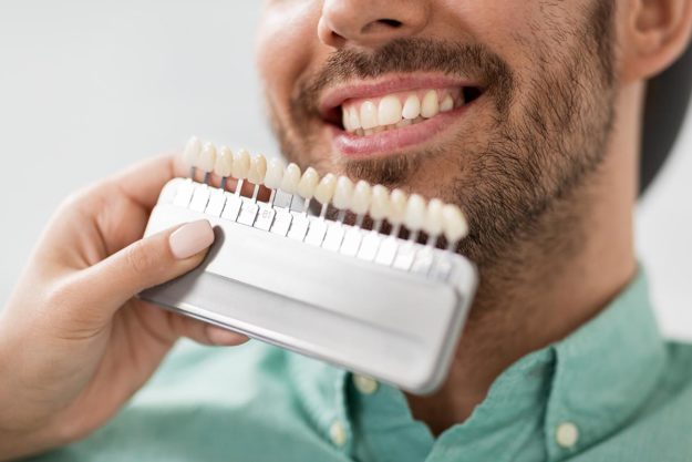 The-Cost-of-Veneers a man smiles next to samples of dental veneers