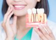 dentist explaining a single tooth implant