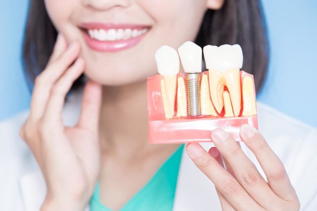 What is a Single Tooth Implant (5) dentist explaining a single tooth implant