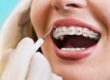 woman getting adult orthodontics