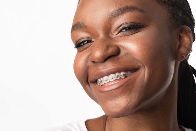 5 Signs You Need Dental Braces Again (1) woman needs dental braces